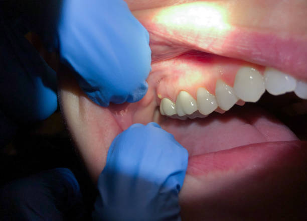 Best Same-Day Emergency Dentist in Dranesville, VA