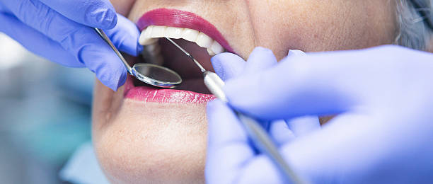 Best Emergency Wisdom Teeth Removal in Dranesville, VA